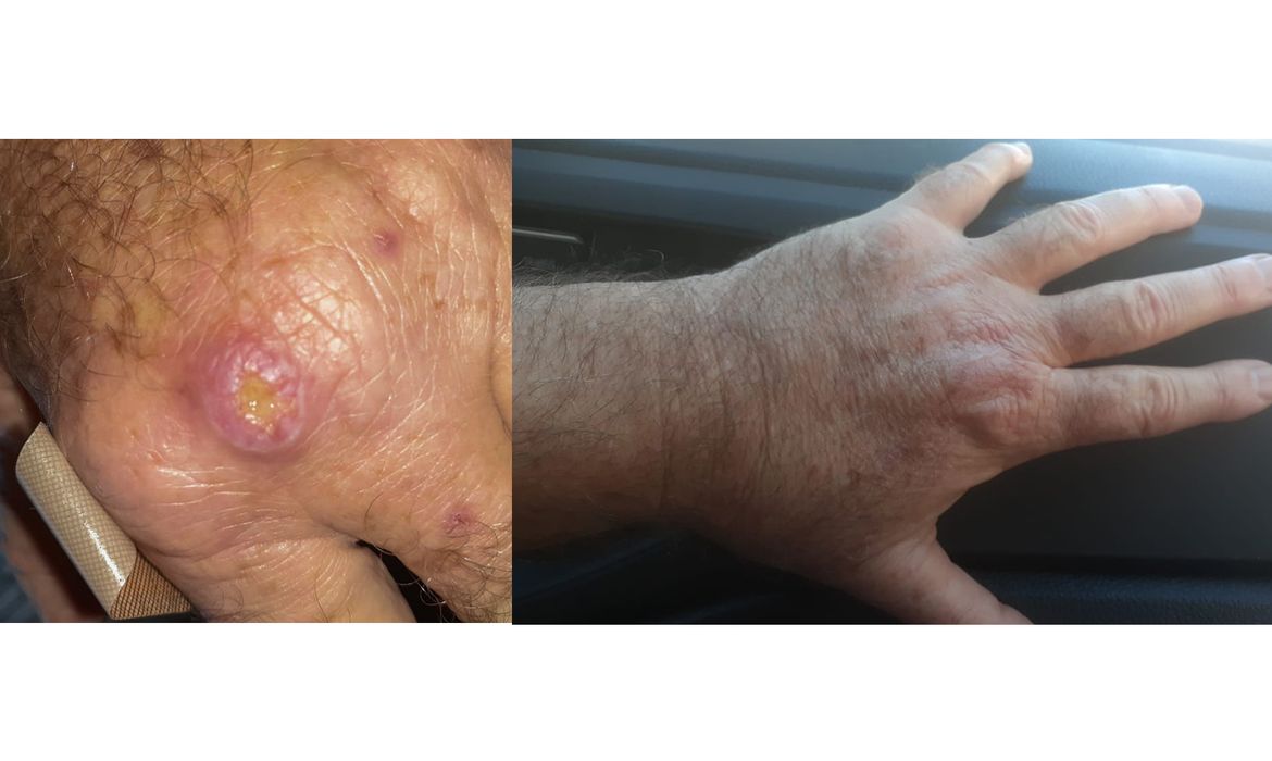 OAB Barro Preto - Especialistas alertam para a falta de informação sobre a leishmaniose